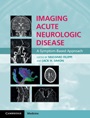 Imaging Acute Neurologic Disease - ISBN 9781107035942
