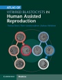 Atlas of Vitrified Blastocysts in Human Assisted Reproduction - ISBN 9781107074095