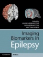 Imaging Biomarkers in Epilepsy - ISBN 9781107108356