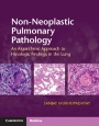 Non-Neoplastic Pulmonary Pathology with Online Resource - ISBN 9781107443501