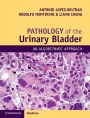 Pathology of the Urinary Bladder - ISBN 9781107593374