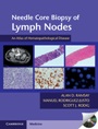 Needle Core Biopsy of Lymph Nodes with DVD-ROM - ISBN 9781107624542
