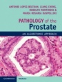 Pathology of the Prostate - ISBN 9781108185653
