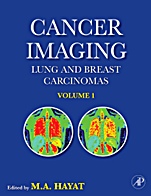 Cancer Imaging: Lung and Breast Carcinomas - ISBN 9780123704689