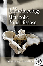 The Bioarchaeology of Metabolic Bone Disease - ISBN 9780123704863