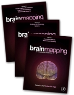 Brain Mapping: An Encyclopedic Reference - ISBN 9780123970251