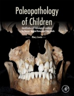 Paleopathology of Children: Identification of Pathological Conditions in the Human Skeletal Remains of Non-Adults - ISBN 9780124104020