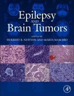 Epilepsy and Brain Tumors - ISBN 9780124170438