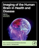Imaging of the Human Brain in Health and Disease - ISBN 9780124186774