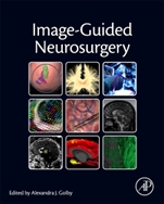 Image-Guided Neurosurgery - ISBN 9780128008706