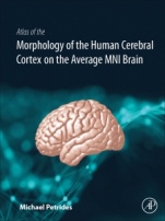 Atlas of the Morphology of the Human Cerebral Cortex on the Average MNI Brain - ISBN 9780128009321