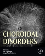 Choroidal Disorders - ISBN 9780128053133