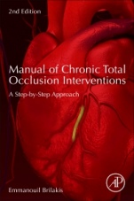Manual of Chronic Total Occlusion Interventions: A Step-by-Step Approach - ISBN 9780128099292