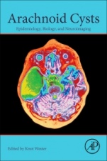 Arachnoid Cysts: Epidemiology, Biology, and Neuroimaging - ISBN 9780128099322