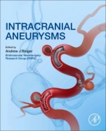 Intracranial Aneurysms - ISBN 9780128117408