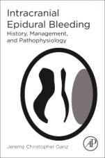 Intracranial Epidural Bleeding: History, Management, and Pathophysiology - ISBN 9780128121597