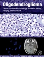 Oligodendroglioma: Clinical Presentation, Pathology, Molecular Biology, Imaging, and Treatment - ISBN 9780128131589