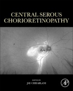 Central Serous Chorioretinopathy - ISBN 9780128168004