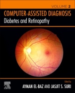 Diabetes and Retinopathy - ISBN 9780128174388