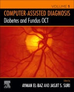 Diabetes and Fundus OCT - ISBN 9780128174401