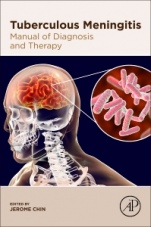Tuberculous Meningitis: Manual of Diagnosis and Therapy - ISBN 9780128188255