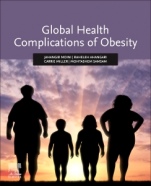 Global Health Complications of Obesity - ISBN 9780128197516