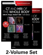 CT and MRI of the Whole Body, 2-Volume Set, 6th Edition - ISBN 9780323113281