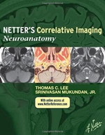 Netters Correlative Imaging: Neuroanatomy - ISBN 9781437704150