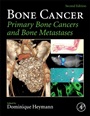Bone Cancer: Primary Bone Cancers and Bone Metastases - ISBN 9780124167216
