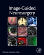 Image-Guided Neurosurgery - ISBN 9780128008706