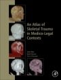 An Atlas of Skeletal Trauma in Medico-Legal Contexts - ISBN 9780128037591