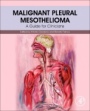 Malignant Pleural Mesothelioma: A Guide for Clinicians - ISBN 9780128127247