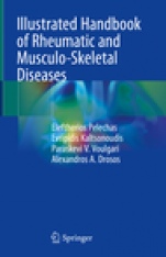 Illustrated Handbook of Rheumatic and Musculo-Skeletal Diseases - ISBN 9783030036638