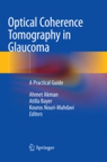 Optical Coherence Tomography in Glaucoma - ISBN 9783030069353