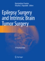 Epilepsy Surgery and Intrinsic Brain Tumor Surgery - ISBN 9783030071158