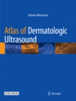 Atlas of Dermatologic Ultrasound - ISBN 9783030078164