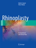Rhinoplasty - ISBN 9783030097974