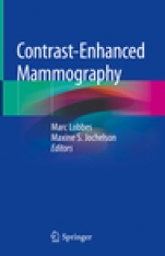 Contrast-Enhanced Mammography  - ISBN 9783030110628