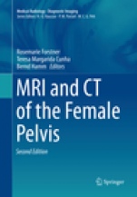 MRI and CT of the Female Pelvis - ISBN 9783030132538