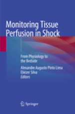 Monitoring Tissue Perfusion in Shock - ISBN 9783030132576