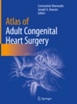 Atlas of Adult Congenital Heart Surgery - ISBN 9783030141622