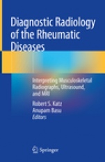 Diagnostic Radiology of the Rheumatic Diseases - ISBN 9783030251154