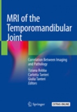 MRI of the Temporomandibular Joint  - ISBN 9783030254209