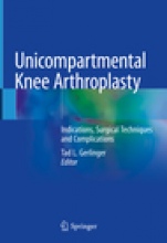 Unicompartmental Knee Arthroplasty - ISBN 9783030274108