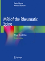 MRI of the Rheumatic Spine - ISBN 9783030329952