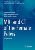 MRI and CT of the Female Pelvis - ISBN 9783319425733