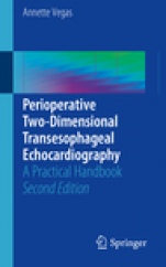Perioperative Two-Dimensional Transesophageal Echocardiography - ISBN 9783319601786