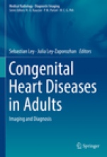 Congenital Heart Diseases in Adults - ISBN 9783319618869