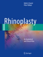 Rhinoplasty - ISBN 9783319673134