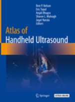 Atlas of Handheld Ultrasound - ISBN 9783319738536